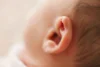 Kenali Apa Itu Mikrotia, Kelainan yang Disebabkan pada Telinga?